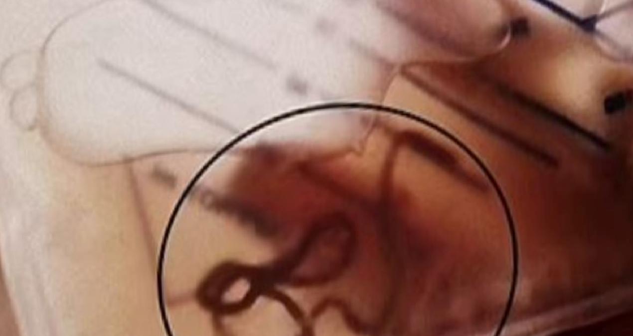 Çiğ çiğ yediği o besin yüzünden idrarından solucan çıktı: Bu hatayı yapmayın!
