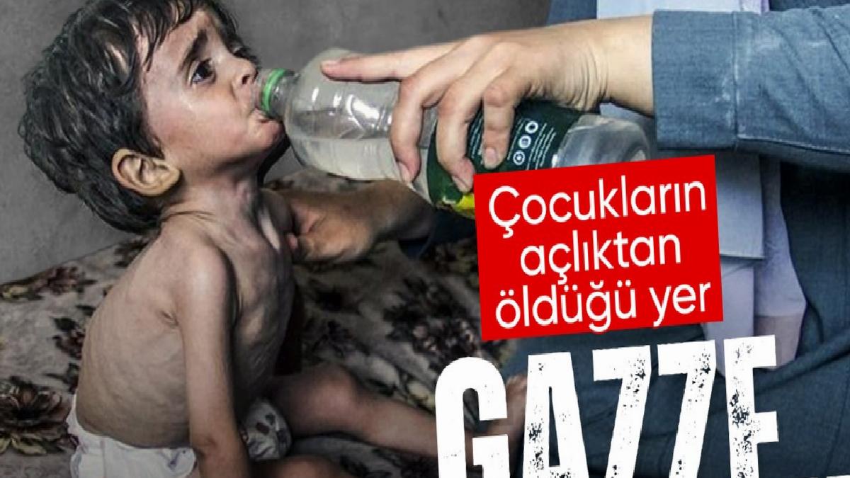 Gazze’de 52 çocuk açlıktan öldü