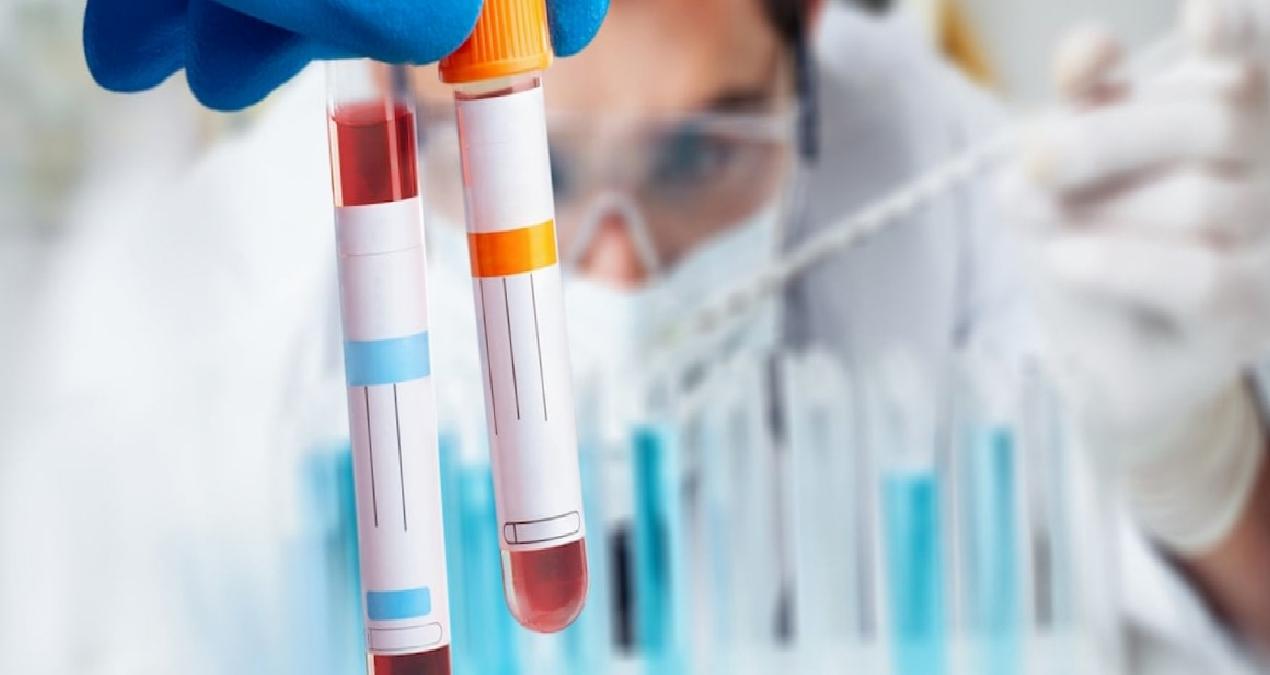 Hatırlamak için yeni umut: Bu test her şeyi değiştirebilir!