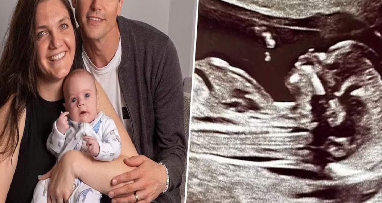 İki kez doğan ‘mucize’ bebek: Doktorlar bile şaşkın