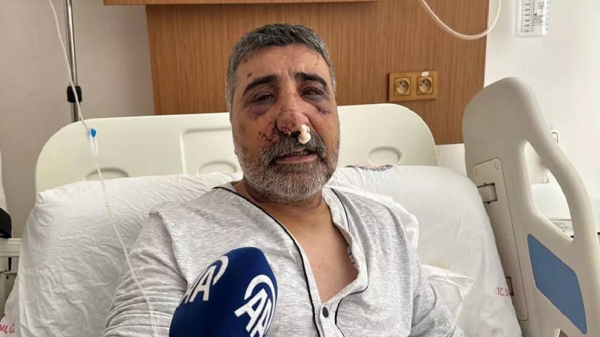İngiliz Boksör Taksi Şoförünü Darbetti