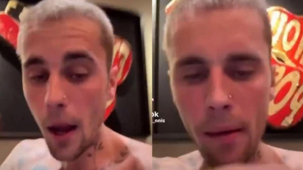 Justin Bieber son hali hayranlarını endişelendirdi! Yorgun ve moralsiz