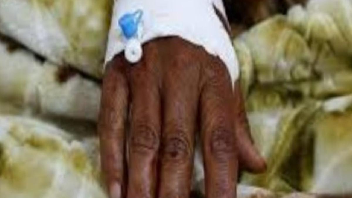 Nijerya’da menenjit alarmı: Salgın 151 can aldı