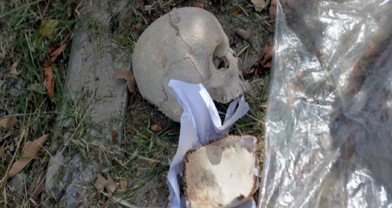Adana’da dehşete düşüren olay: Çöpten çocuk kafatası çıktı!