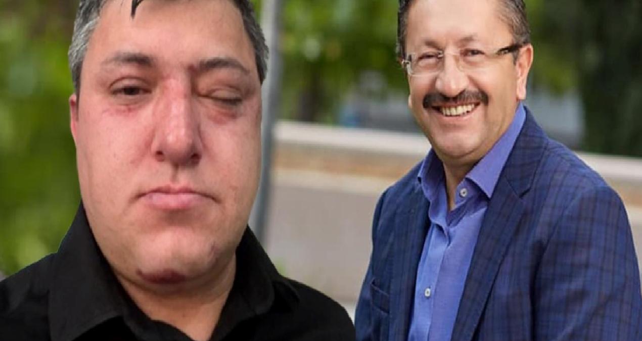 Akılalmaz iddia… Buraya kadar geldik mi? Belediye başkanı ve yardımcıları işçi dövdü