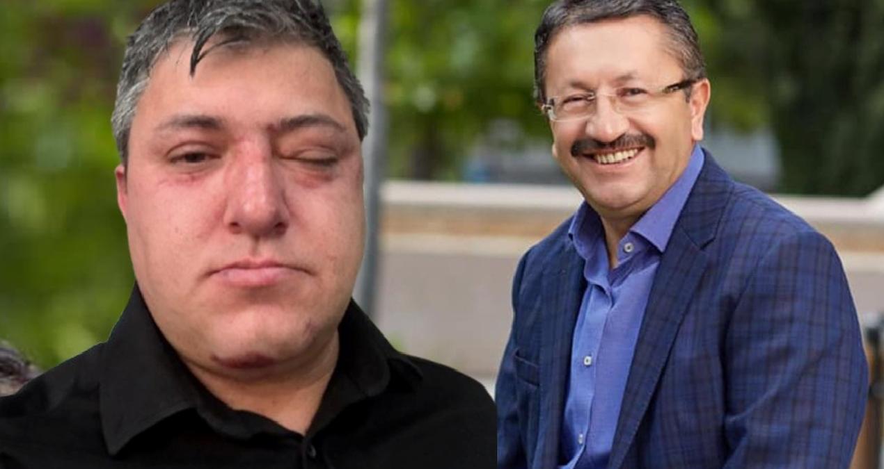 Akılalmaz iddia… Buraya kadar geldik mi? Belediye başkanı ve yardımcıları işçi dövdü