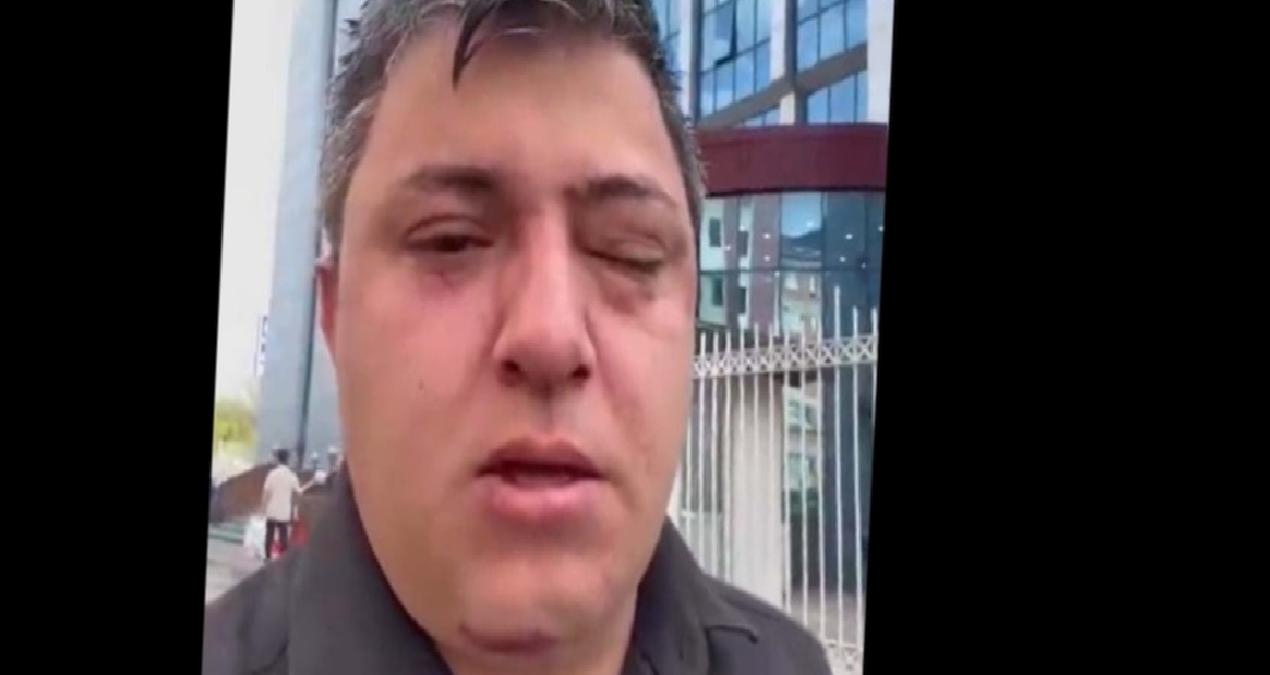 AKP’li ‘belediye yöneticileri işçi darp etti’ iddiası