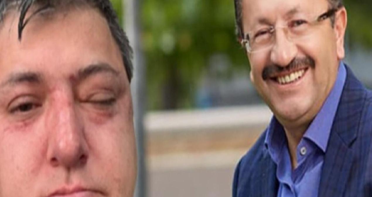 Altındağ Belediyesi personelinin darbedilmesine ilişkin soruşturmada zabıta müdürü tutuklandı!