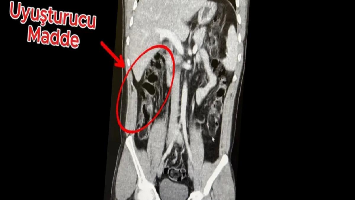 Antalya Havalimanında Uyuşturucu Ticareti Operasyonu