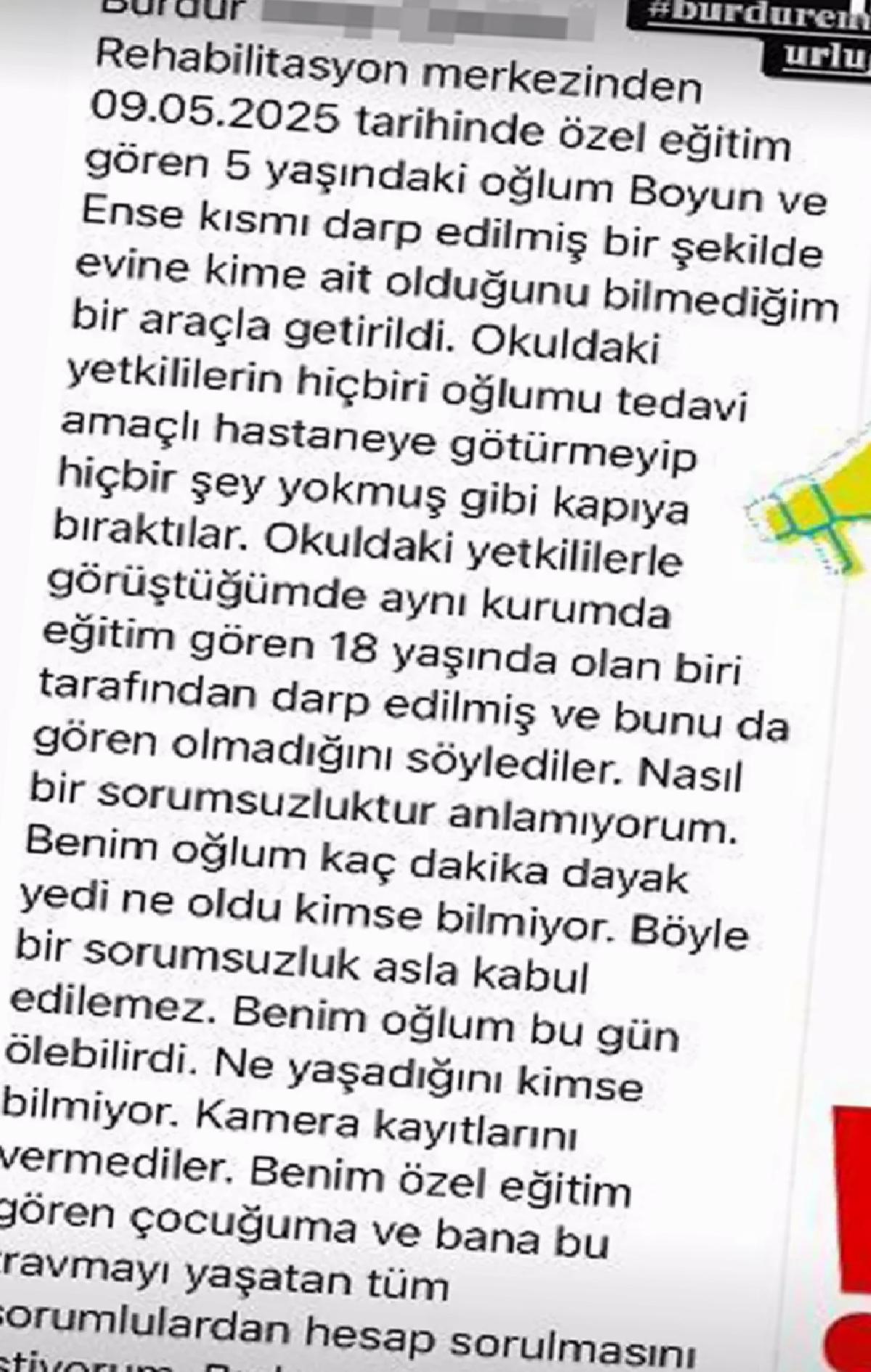 Burdur’da Özel Gereksinimli Çocuğa Darp İddiası