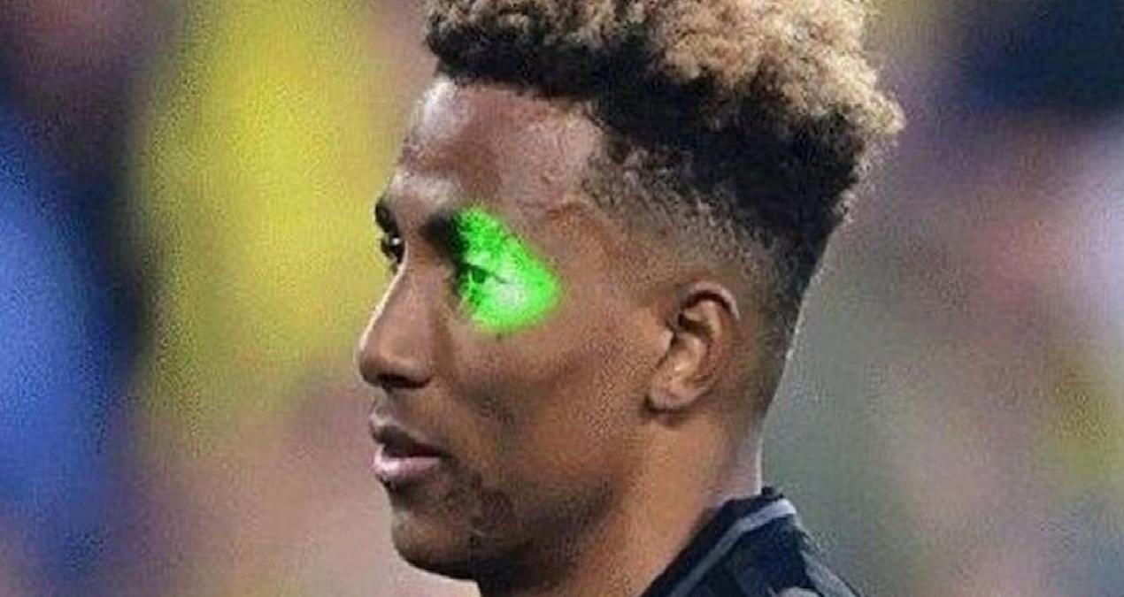 Derbinin ardından lazer gözaltısı