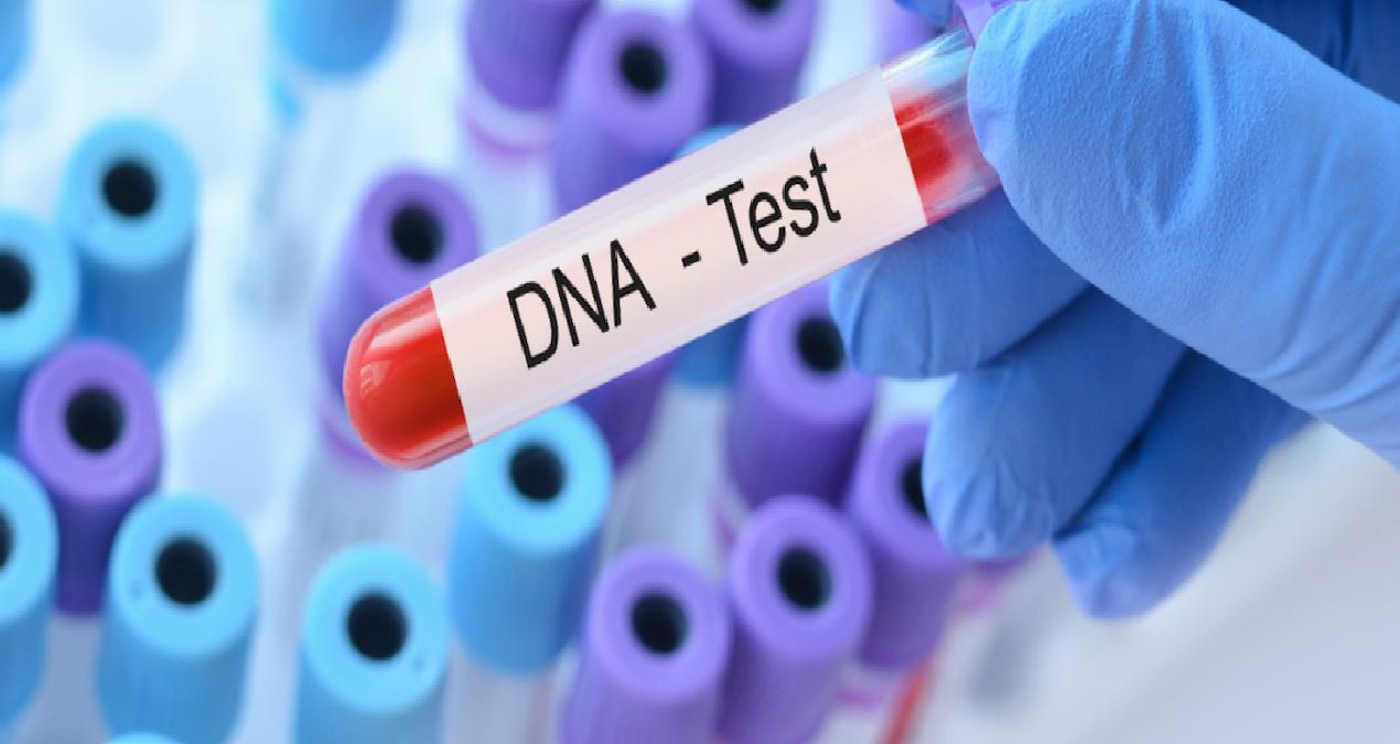 -Eğlencesine DNA testi yaptıran kadın kocasıyla kardeş çıktı