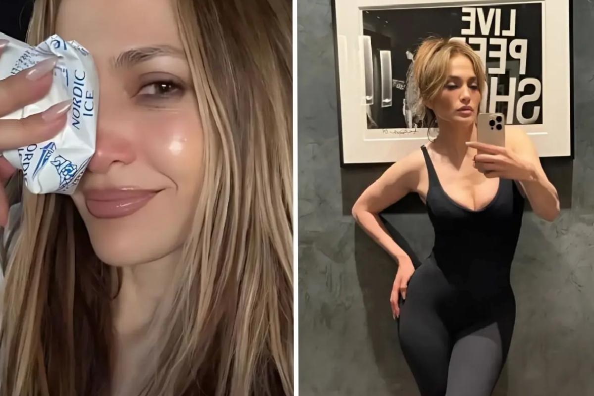 Jennifer Lopez, Amerikan Müzik Ödülleri provaları sırasında yüzünden yaralandı