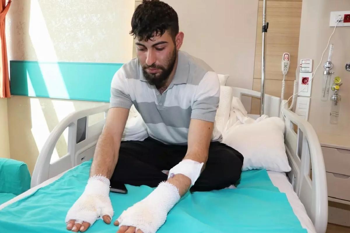 Otomobil Hararet Yaptı, Teknisyen Yandı